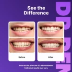 Dr Dent Purple Teeth Whitening Strips ( The Family Pack ) - Image 3